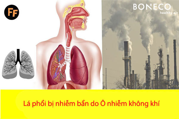 Không khí ô nhiễm nghiêm trọng tại Hà Nội: Người dân cần làm gì để bảo vệ sức khỏe? 2