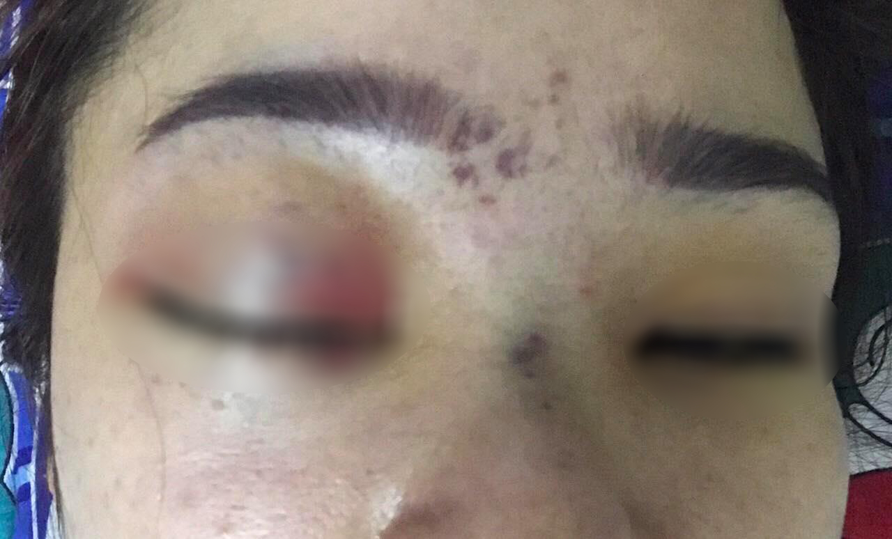 Chủ spa nơi cô gái nâng mũi bị mù mắt từng bị đình chỉ hoạt động