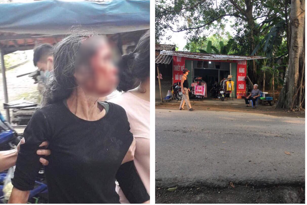 Phú Thọ: Con rể chém mẹ vợ nhập viện trong tình trạng nguy kịch