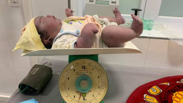 Bé sơ sinh nặng 5,5 kg chào đời bằng phương pháp sinh thường ở Nghệ An