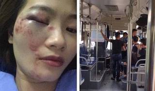 Nữ nhân viên xe buýt bị 4 nam hành khách đánh nhập viện