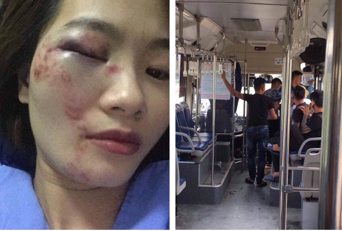 Nữ nhân viên xe buýt đau đớn kể lại giây phút bị 4 thanh niên đánh hội đồng