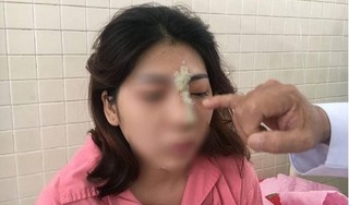 Cô gái 21 tuổi bị mù mắt sau khi đi nâng mũi ở spa