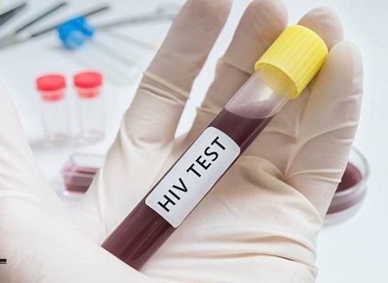 Chuyên gia nêu quy trình xét nghiệm HIV chuẩn nhất