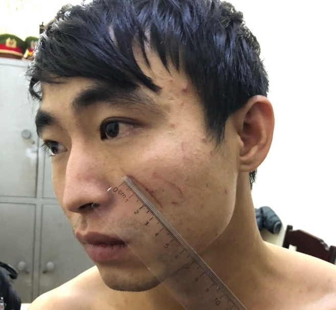 Phẫn Nộ Lời Khai Của Kẻ Sát Hại Bạn Gái Trong Nhà Nghỉ Ở Thanh Hóa