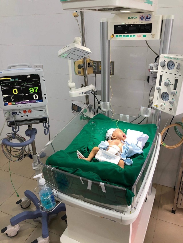 Nghệ An: Cháu bé mới sinh đã bị rơi toàn bộ nội tạng ra ngoài 3