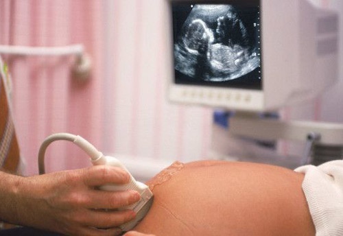 Bệnh viện nói gì khi bác sĩ bị tố tắc trách khiến thai nhi 40 tuần chết thảm?
