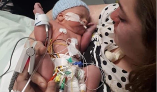 Bé trai 10 tháng tuổi được phẫu thuật gắn van tim bò