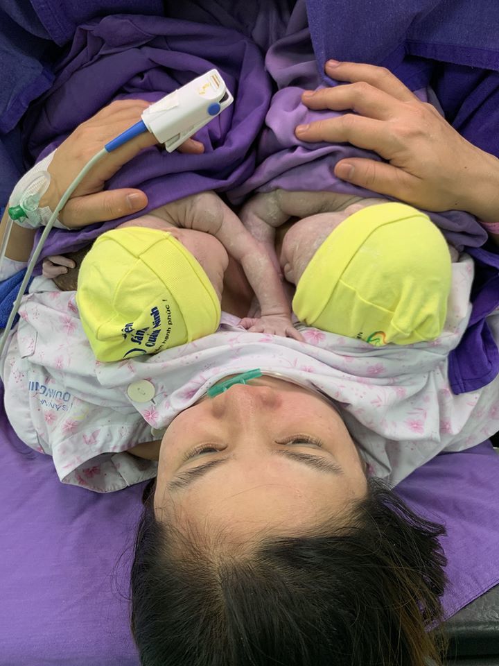 Quảng Ninh: Cặp sinh đôi chào đời trong bọc ối  2