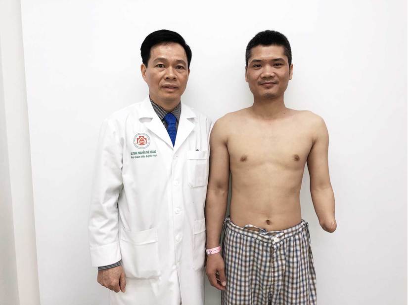 Việt Nam thực hiện ca phẫu thuật đầu tiên trên thế giới ghép chi thể người sống sang cho người sống