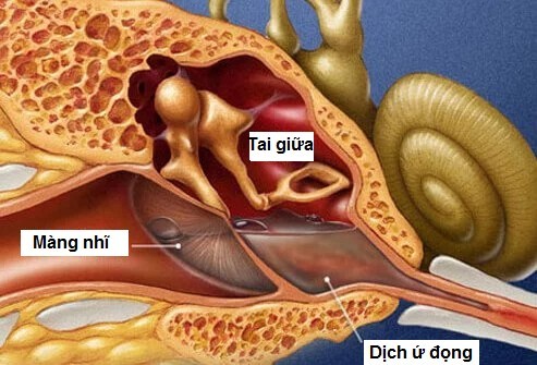 viêm mũi không do dị ứng