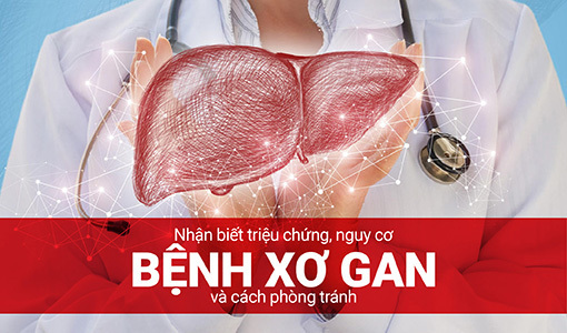 Nhận biết triệu chứng, nguy cơ bệnh xơ gan và cách phòng tránh