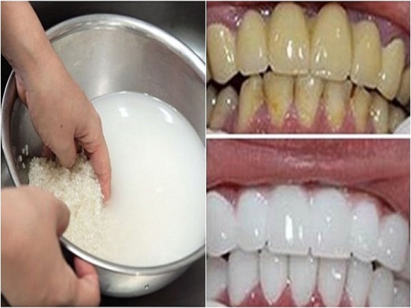 Bí quyết từ thiên nhiên để có hàm răng trắng sáng ngay tại nhà