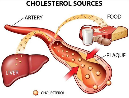 Nguyên nhân ít ai ngờ khiến cholesterol cao