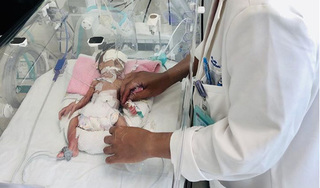 Phẫu thuật tiêu hóa cho em bé sinh non và nhẹ cân nhất Việt Nam