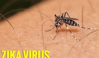 Những điểm bất ngờ của virus Zika và cách điều trị