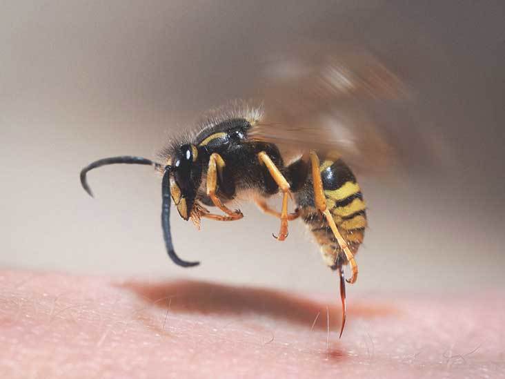 Cách chữa ong đốt không đau, không dùng thuốc
