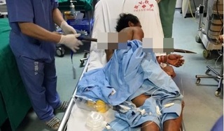 Ekip hơn 10 y bác sĩ cứu bệnh nhân bị xà beng đâm xuyên ngực