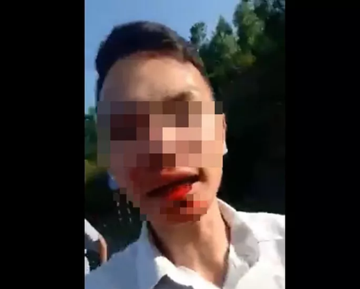Có thật tài xế bị đánh chảy máu miệng khi làm việc với thanh tra giao thông Đà Nẵng?