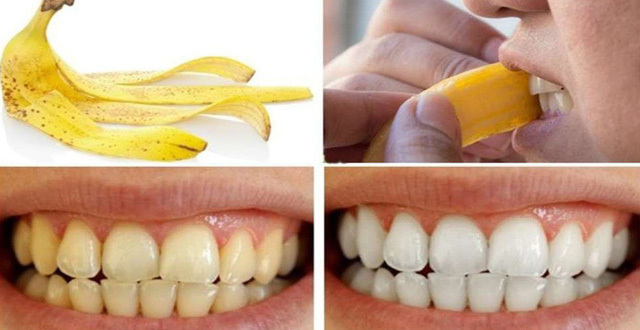 4 mẹo đơn giản giúp bạn sở hữu hàm răng trắng sáng hiệu quả