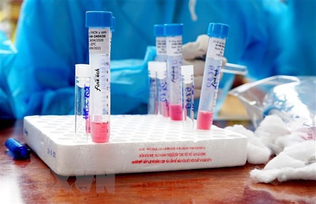 Phú Yên kiến nghị Bộ Y tế hỗ trợ 1.000 test xét nghiệm Covid-19