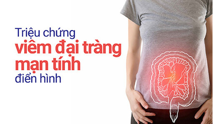 Những triệu chứng viêm đại tràng mạn tính điển hình, dễ nhận biết
