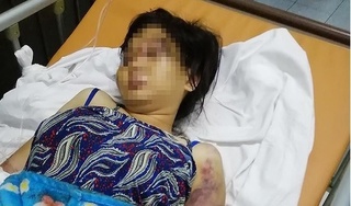 Truy tố 3 đối tượng tra tấn cô gái như thời trung cổ dẫn đến sẩy thai