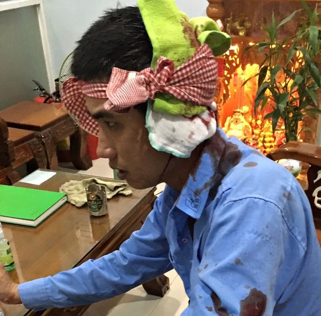 Nhân viên Trạm BOT Ninh Xuân bị hành hung phải nhập viện