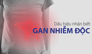 Dấu hiệu nhận biết gan nhiễm độc và biện pháp bảo vệ gan