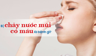 Bị chảy nước mũi có máu là bệnh gì? Có nguy hiểm không?
