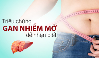 Những triệu chứng gan nhiễm mỡ điển hình, dễ nhận biết 