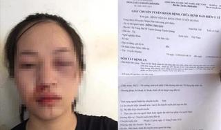 CSGT Tuyên Quang lên tiếng khi bị tố dùng gậy vụt vào mặt người phụ nữ đi xe máy