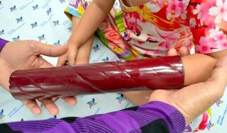 Cắt cả chân giường để đưa bé 3 tuổi đến bệnh viện cấp cứu