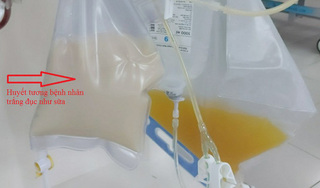 Cứu sống người phụ nữ có huyết tương trắng đục như sữa
