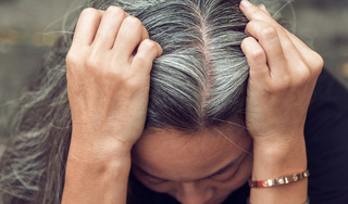Nguyên nhân và cách điều trị bệnh bạc tóc sớm