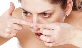 Khi nặn mụn nêm lưu ý điều gì để không bị thâm, sưng đỏ?