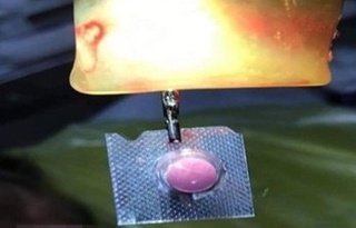 Vô tình nuốt luôn vỏ khi uống thuốc, nam thanh niên bị xuất huyết niêm mạc