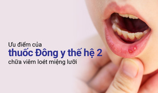 Ưu điểm đặc biệt của thuốc Đông y thế hệ 2 chữa viêm loét miệng lưỡi