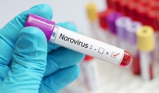  Hàng chục sinh viên Trung Quốc nghi nhiễm norovirus