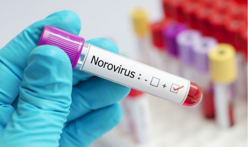 Hàng chục sinh viên Trung Quốc nghi nhiễm norovirus