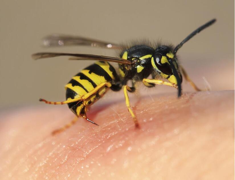 Bị ong chích vào lưỡi khi đang ăn, nam thanh niên không thể ngậm được miệng