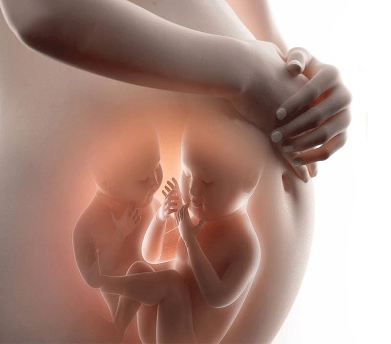 Sản phụ mắc hội chứng truyền máu song thai hiếm gặp 