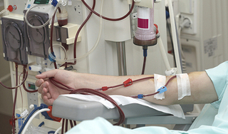 Việt Nam có khoảng 30.000 bệnh nhân suy thận cần lọc máu