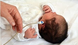 Hội chứng hiếm gặp khiến bé 4 tháng tuổi nghe kém, mắt chuyển xanh