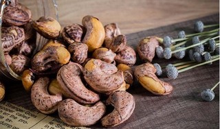 Những lưu ý khi ăn hạt điều để không gây hại cho sức khỏe