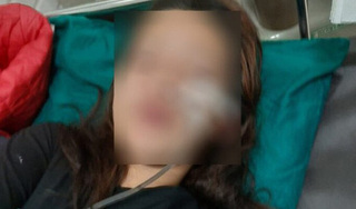 Thiếu nữ 15 tuổi uống thuốc diệt cỏ tự tử sau khi bị mắng