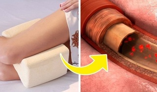 Tại sao nên kẹp một chiếc gối vào giữa hai chân khi ngủ?