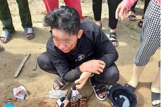Quảng Bình: Nam sinh đi học về bị nhóm người chặn đánh đến bất tỉnh