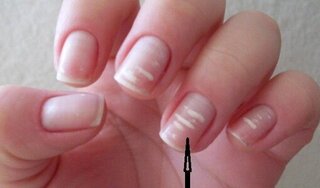 Cơ thể bạn có thể đang gặp vấn đề nếu bộ phận này đột ngột chuyển sang màu trắng