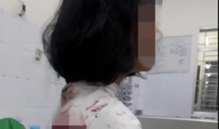 Nguyên nhân nữ sinh lớp 11 ở Đồng Nai bị đâm trọng thương